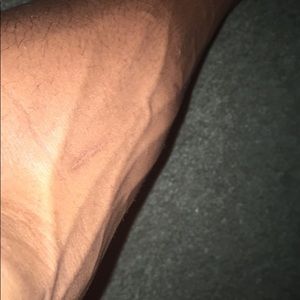 Meet your Posher, Darius